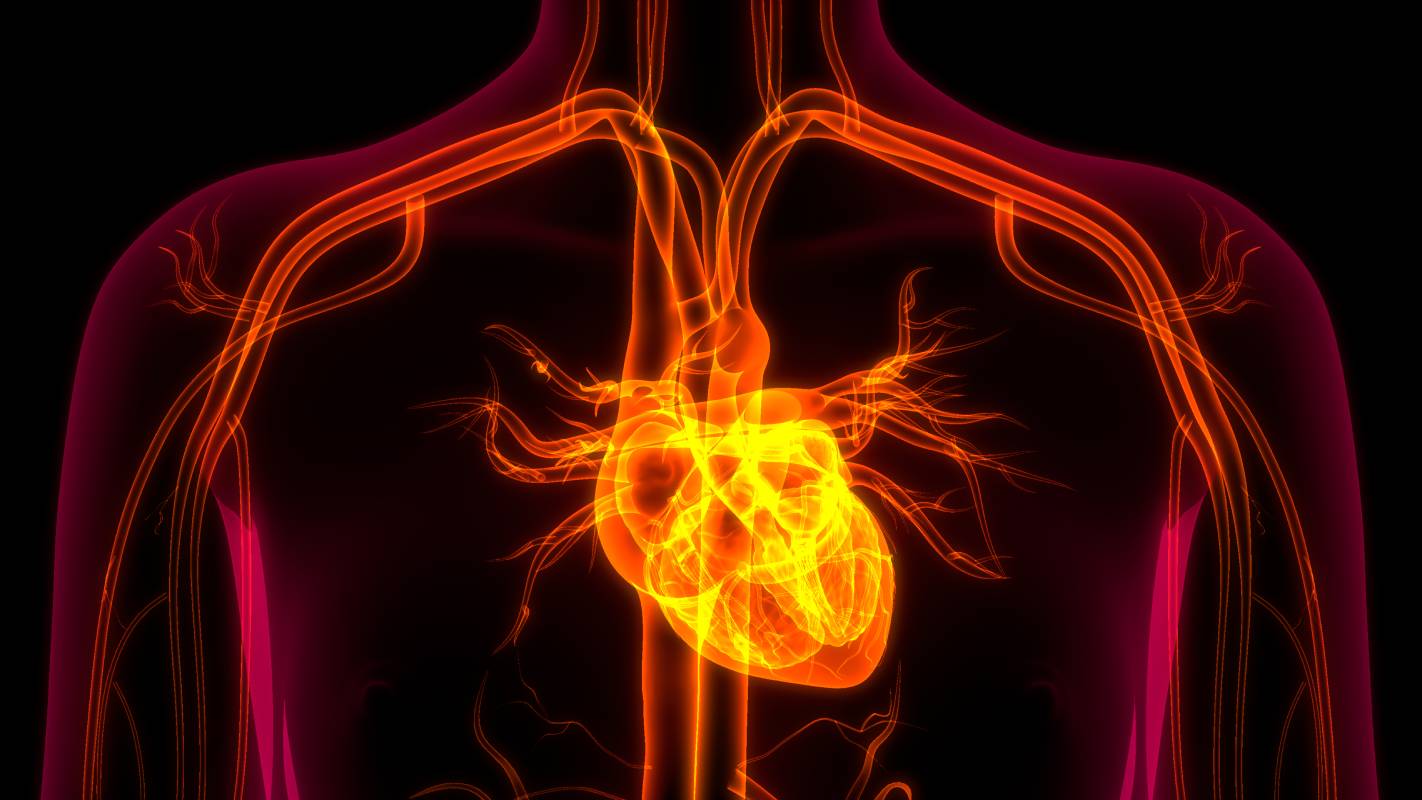 Myocardial injury after non cardiac surgery ambulatory anesthesia 